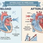 afterload vs preload